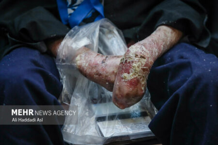 ارسال ۱۰۰۰ دارو و ۹۷۰ پانسمان بیماران پروانه ای ارسال ۱۰۰۰ دارو و ۹۷۰ پانسمان بیماران پروانه ای