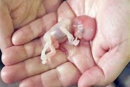 صدور کیفرخواست برای 9 متهم پرونده سقط جنین غیرقانونی در گلستان صدور کیفرخواست برای 9 متهم پرونده سقط جنین غیرقانونی در گلستان